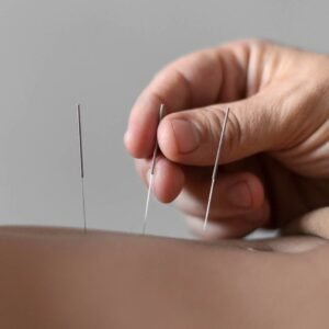 Curso de Técnico en Medicina Tradicional China y Lesiones Musculoesqueléticas