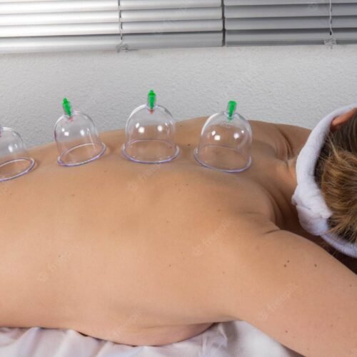 Masaje con Ventosas